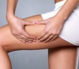 How to get rid of cellulite quickly. Suggestions within anyone’s reach
