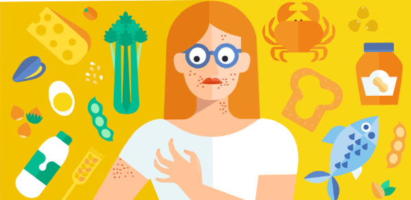 Food, allergy and edema | Symptoms, types and characteristics